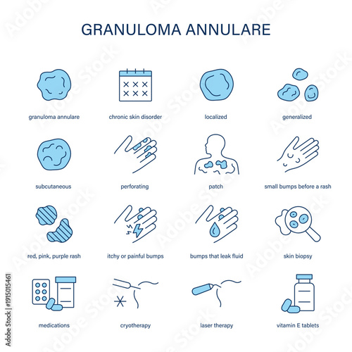Granuloma Annulare symptoms, diagnostic and treatment vector icon set