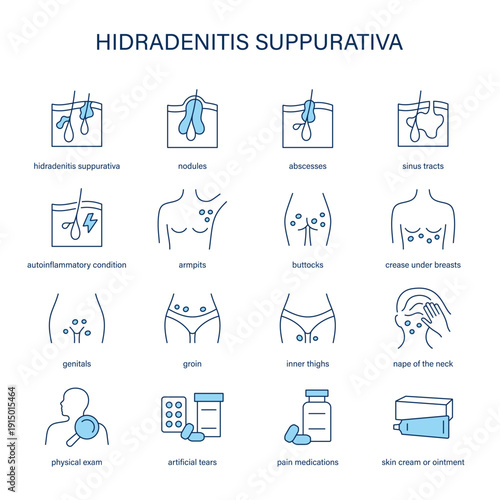 Hidradenitis Suppurativa symptoms, diagnostic and treatment vector icon set