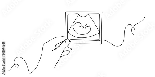 Single continuous line art style: Hand holding an ultrasound image of a baby in the womb. Line art Illustration Editable stroke.