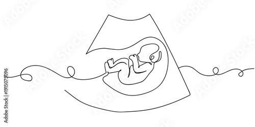 Single continuous line art style. Ultrasound image of a fetus. Line art Illustration Editable stroke.