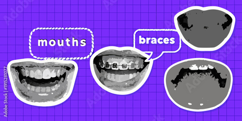 Illustrative mouths with braces depicted on a purple grid background