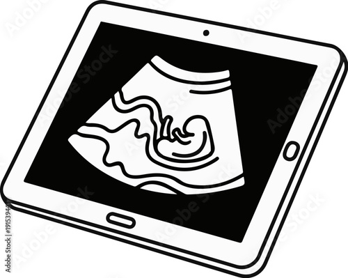 A digital tablet displays an ultrasound image of a fetus