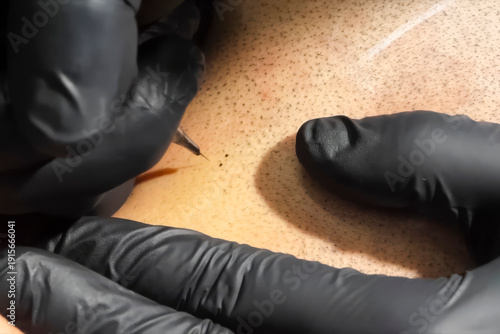 Tattooing with a needle on the scalp in the form of shaved hair.