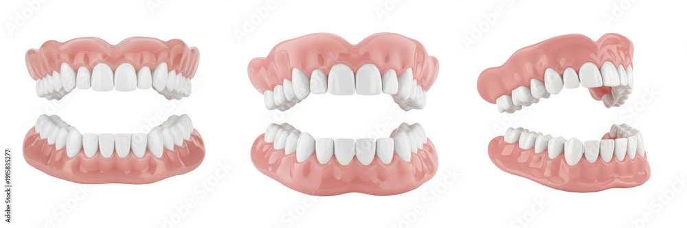 Fototapeta premium Denture set isolated on white background, full dentures prosthodontics close up, complete removable false teeth for upper and lower jaw replacement, dental prosthesis model used in dentistry clinic