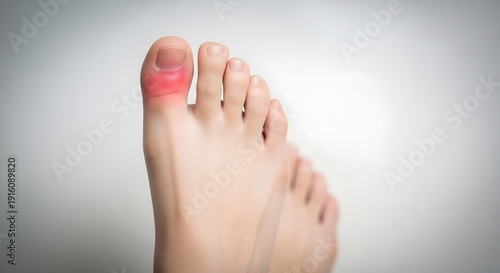 Closeup of a foot with a red and swollen big toe against a plain background