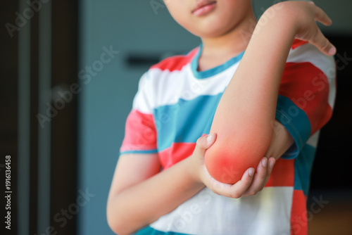 Schilderij op canvas Asian boy holding red inflamed elbow with hand suffering from joint pain or muscle injury