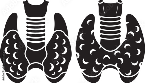 Stylized black and white vector illustration of two human thyroid glands with trachea, medical concept