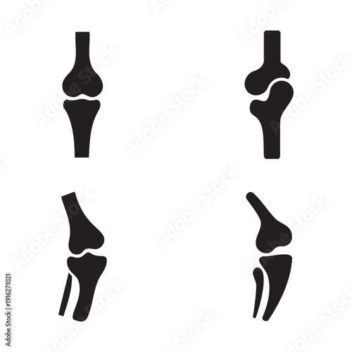 Joint icon set with knee and bone silhouettes for orthopedic and medical design