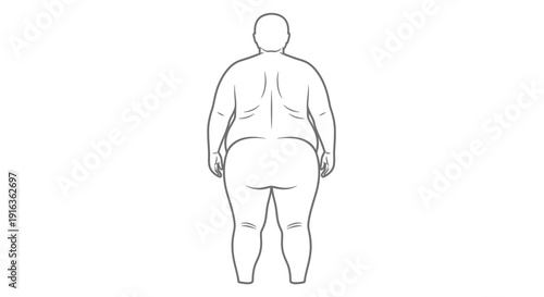 Obese Person Back View Outline, Body Shape, Health Issues, Weight Problem