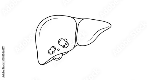Human Liver Anatomy with Tumors, Medical Illustration