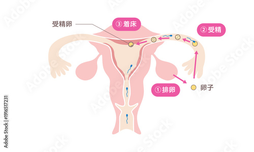 人の受精と着床の過程を示す医療イラスト（日本語）