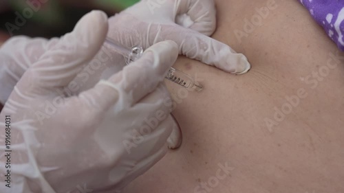 close up doctor is injecting enoxaparin injection to belly with syringe