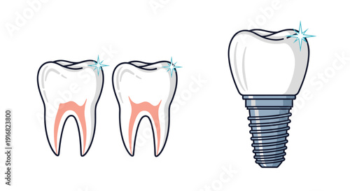 Educational dental illustration showing human teeth structure with cross sections alongside a modern dental implant screw and crown.