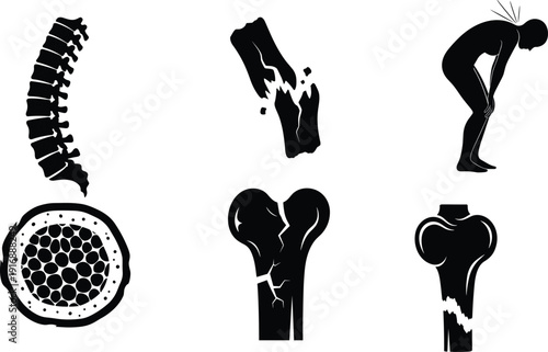Black silhouette of human bones and spine with injuries fracture injury