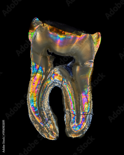 Konstfotografi Human tooth under cross polarized light, rainbow interference colors, abstract d