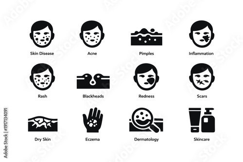 Common skin conditions and treatments: acne, pimples, inflammation, eczema, skincare