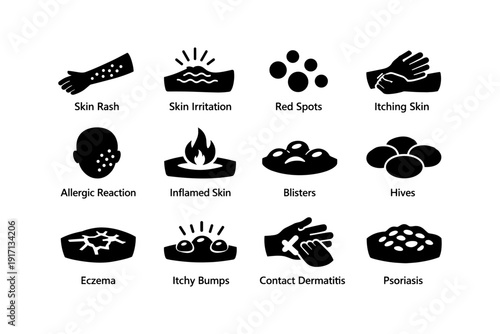 Common skin conditions: rash, irritation, red spots, blisters, eczema, psoriasis