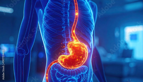 3D medical illustration of human digestive system highlighting inflamed stomach and esophagus, representing acid reflux, GERD, and gastric disorder concept.