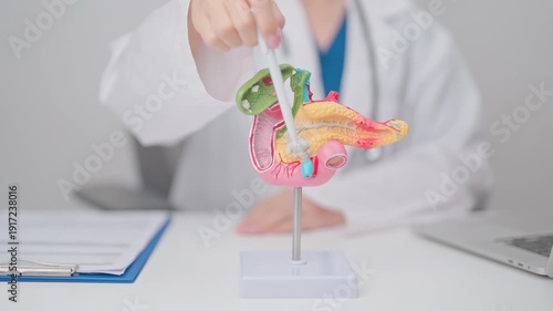 Doctor with human Pancreatitis anatomy model with Pancreas, Gallbladder, Bile Duct, Duodenum, Small intestine. Pancreatic cancer, Acute and Chronic pancreatitis, Digestive system and Health concept