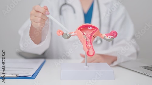 Doctor with Uterus and Ovaries anatomy model. Ovarian and Cervical cancer, Cervix disorder, Endometriosis, Hysterectomy, Uterine fibroids, Reproductive system, Pregnancy and health concept