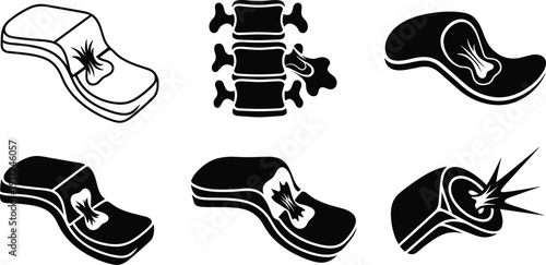 Black and white of spine injuries back injury pain vertebrae