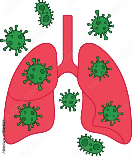 Illustration of Lungs Infected by Viruses for Healthcare and Educational Use