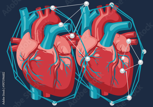 Detailed illustration showcases a heart twin surgery plan, highlighting interconnected hearts with a network. A visually striking and informative medical concept.