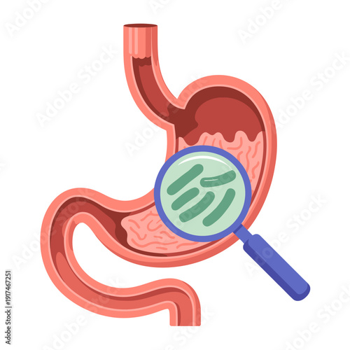 Human stomach anatomy with magnifying glass showing bacteria  medical illustration