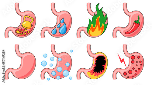 Cartoon illustrations of various stomach conditions and digestive issues explained  health concepts
