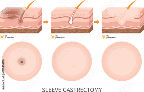 Medical vector illustration showing skin layers hair follicle healing process and UV protection benefits for dermatology education and skincare treatment.