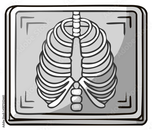 Stylized cartoon rib cage x ray showing human skeletal anatomy