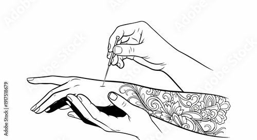 Hand applying acupuncture needle to decorated arm with floral patterns