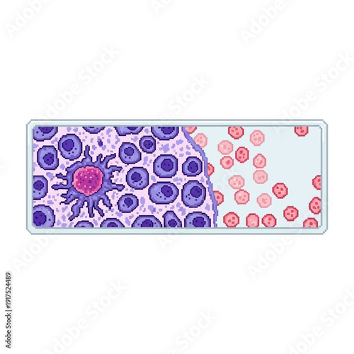 Microscopic view of blood cells, including red blood cells and lymphocytes.