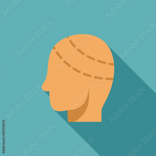 Human head showing surgical markings for hair restoration or cosmetic procedure