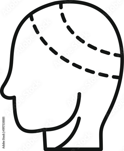 Human head profile illustrating hair transplant surgery areas