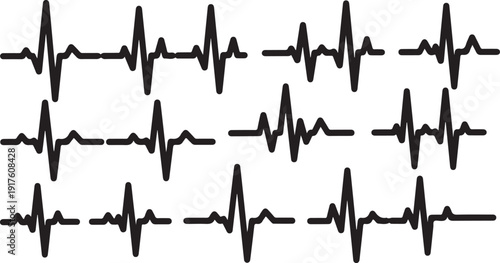Multiple ECG heartbeat tracings on a white background displayed