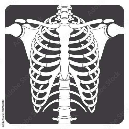 An x ray image displaying the human skeletal structure of the torso