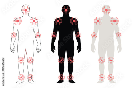 Human body diagrams showing joint pain locations with varying skin tones