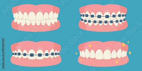 Dental Transformation: A comprehensive illustration of a smile, progressing through stages of dental treatment, showcasing braces and enhanced aesthetics.
