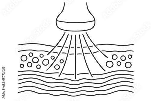 A white line art illustration on a black background depicting an ultrasound transducer emitting waves into multiple layers of skin tissue for a medical or cosmetic procedure.