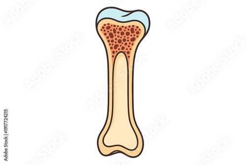 This medical illustration shows a cross-section of a human long bone, revealing internal anatomy such as spongy bone, marrow, and compact bone on a black background.