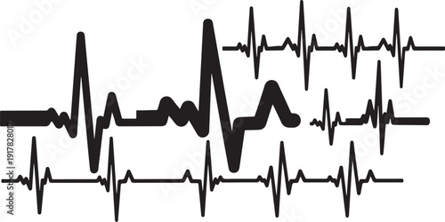 Multiple ECG heartbeat lines on a medical chart display