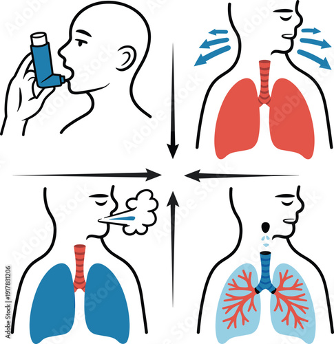 Respiratory System Breathing Process Diagram with Inhalation and Exhalation Arrows, Lungs and Trachea Anatomy Illustration, Asthma Inhaler Usage Medical Vector on White Background