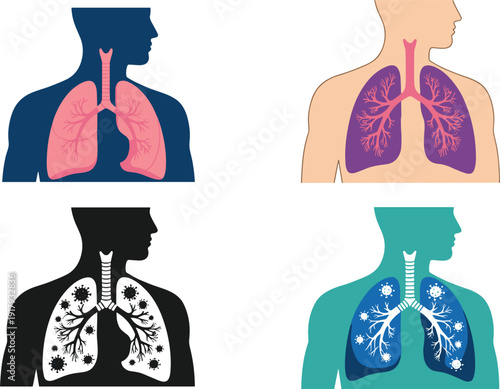 Human lungs anatomy illustrations showing healthy and infected conditions isolated on white background medical vector