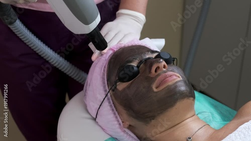 Carbon Laser Peel Facial Treatment in Beauty Clinic