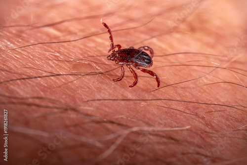 Large camel ticks Hyalomma sp. spread Crimean-Congo hemorrhagic fever. They have spread to Crimea. An unsucked tick crawls on a person's hand.