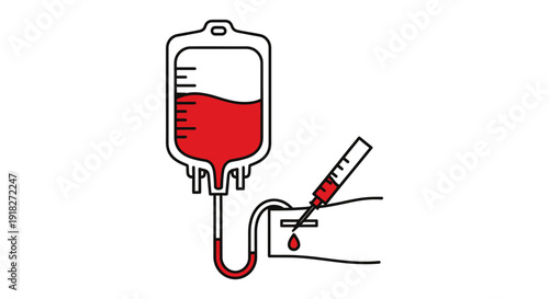 Blood transfusion medical IV equipment.