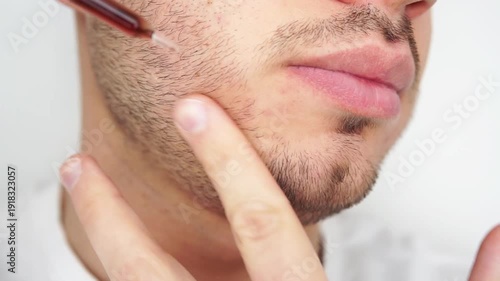 Young man applying beard growth oil with pipette close up