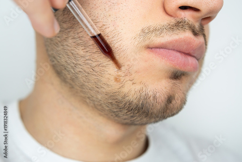 Young man applying beard growth oil with pipette close up