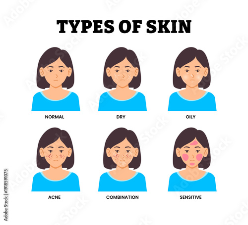 Different types of skin types with female character. Labeled normal, dry, oily, acne, combination, sensitive. dermatology and treatment of disease. Beauty skin care. Cosmetic ads concept illustration.